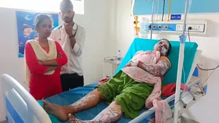 गैस सिलेंडर ब्लास्ट से दहला रुद्रपुर, 5 झुलसे; 4 अस्पताल में भर्ती